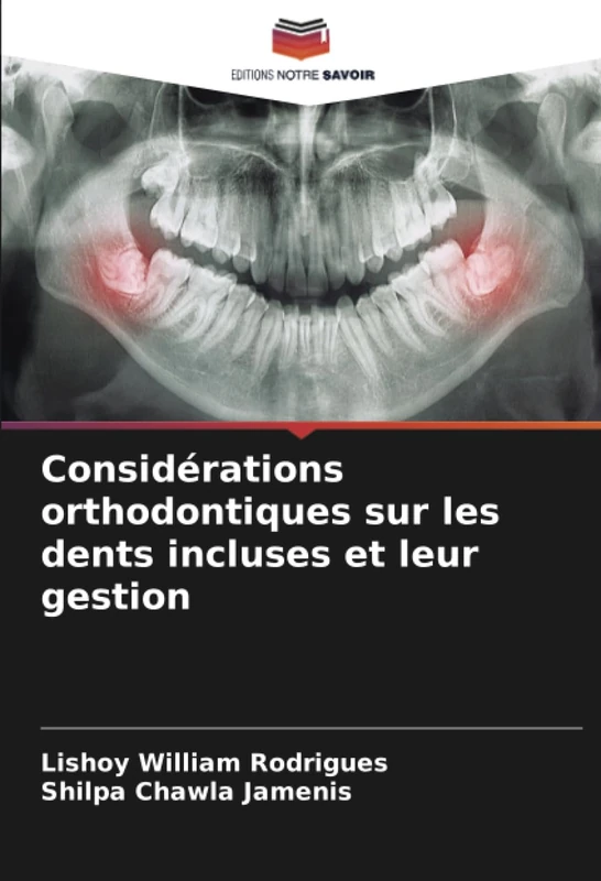 Considérations orthodontiques sur les dents incluses et leur gestion