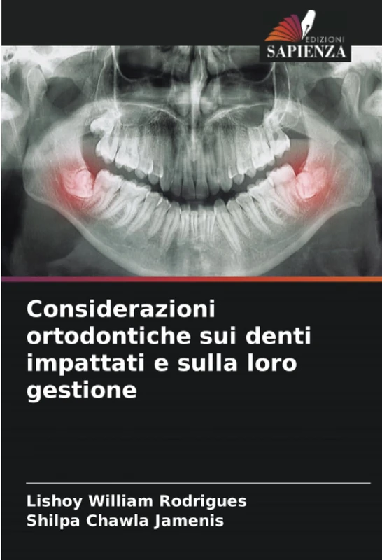 Considerazioni ortodontiche sui denti impattati e sulla loro gestione