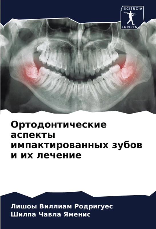 Ортодонтические аспекты импактированных зубов и их лечение