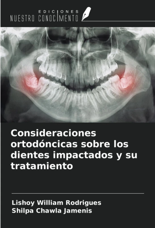 Consideraciones ortodóncicas sobre los dientes impactados y su tratamiento