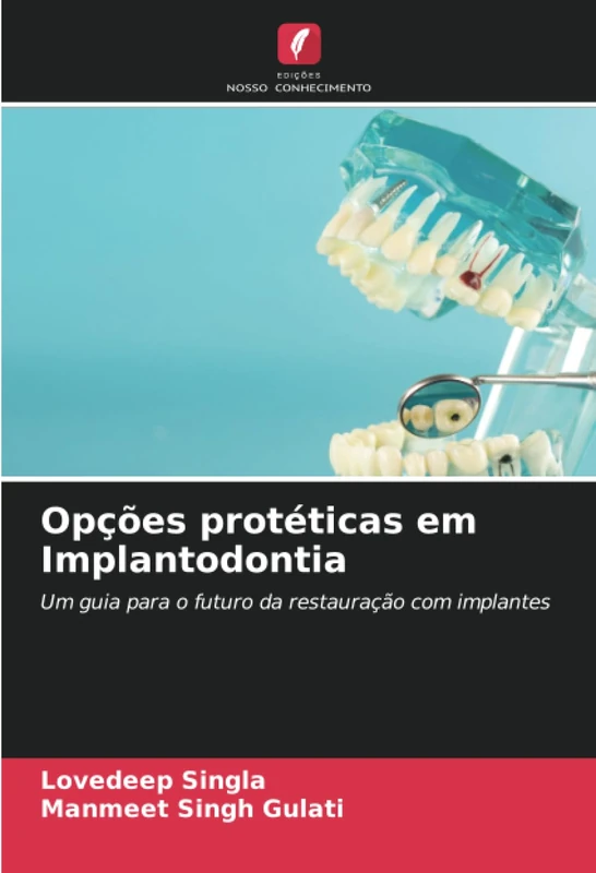 Opções protéticas em Implantodontia: Um guia para o futuro da restauração com implantes