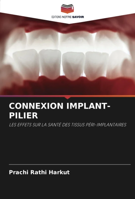 CONNEXION IMPLANT-PILIER: LES EFFETS SUR LA SANTÉ DES TISSUS PÉRI-IMPLANTAIRES