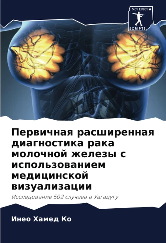 Первичная расширенная диагностика рака молочной железы с использованием медицинской визуализации: Исследование 502 случаев в Уагадугу: Issledowanie 502 sluchaew w Uagadugu