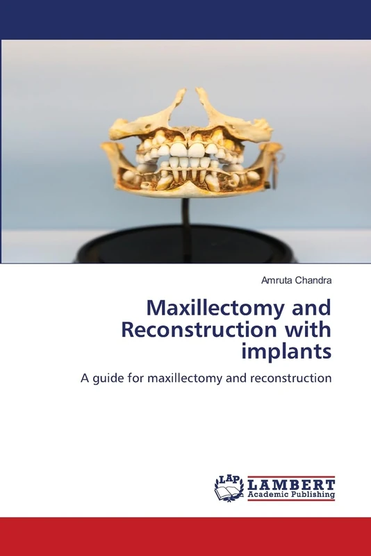 Maxillectomy and Reconstruction with implants: A guide for maxillectomy and reconstruction