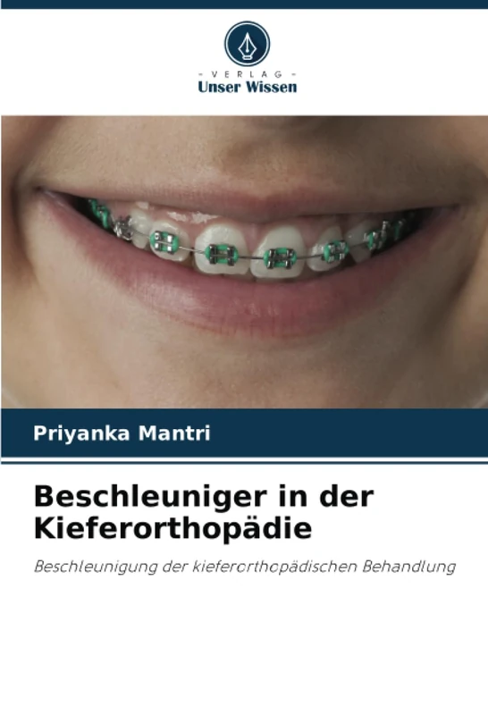 Beschleuniger in der Kieferorthopädie: Beschleunigung der kieferorthopädischen Behandlung