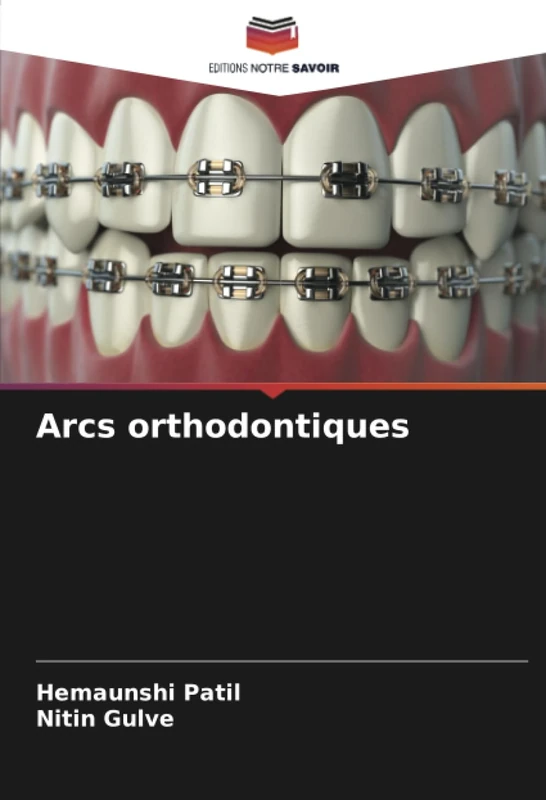 Arcs orthodontiques