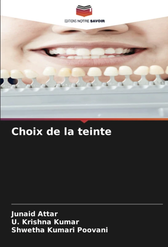 Choix de la teinte