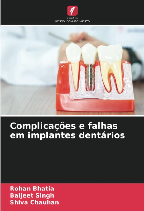 Complicações e falhas em implantes dentários
