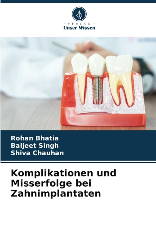 Komplikationen und Misserfolge bei Zahnimplantaten - Image 1