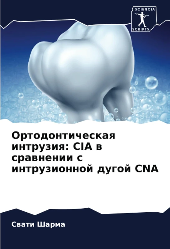 Ортодонтическая интрузия: CIA в сравнении с интрузионной дугой CNA - Image 1
