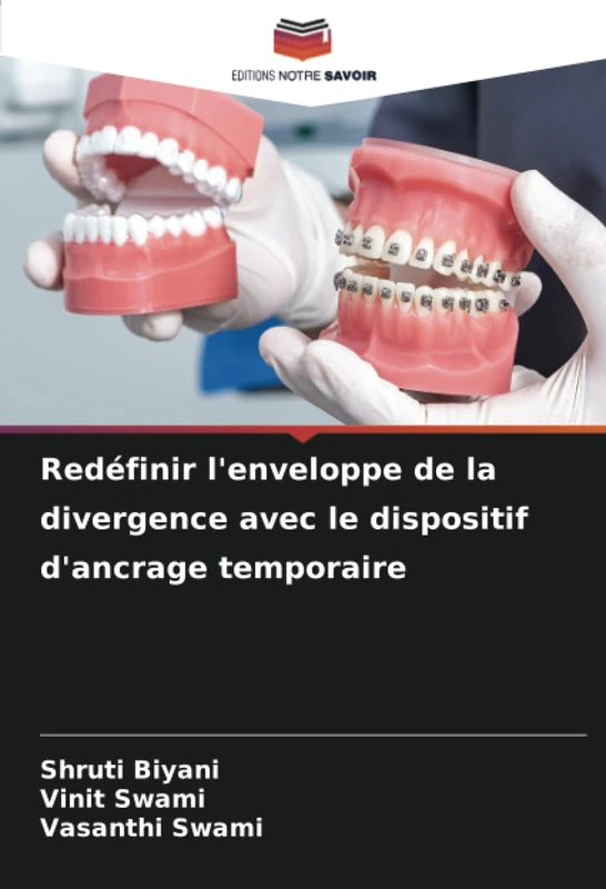 Redéfinir l'enveloppe de la divergence avec le dispositif d'ancrage temporaire