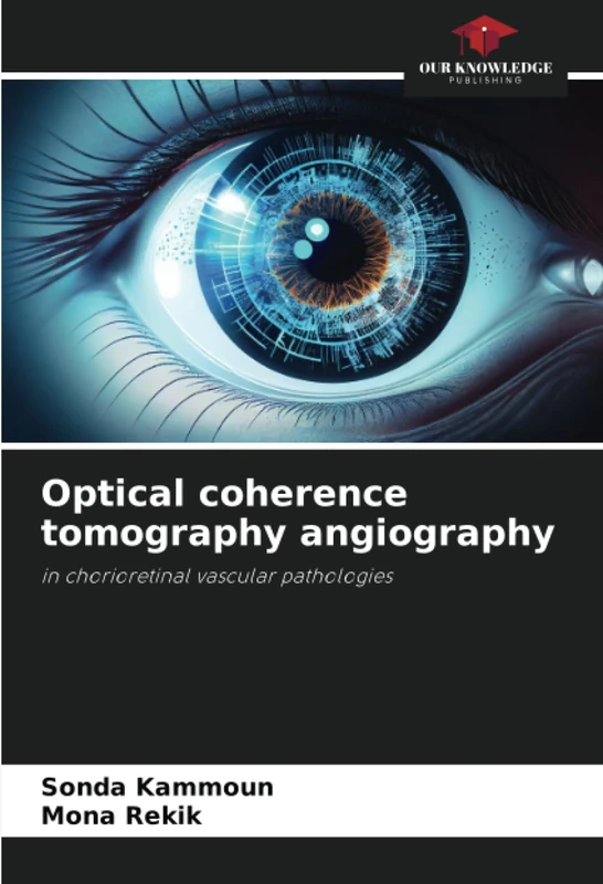 Optical coherence tomography angiography: in chorioretinal vascular pathologies