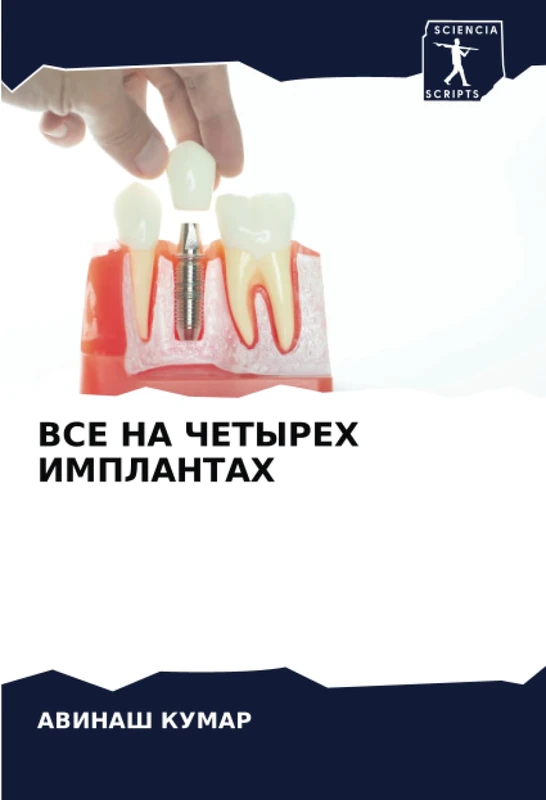 ВСЕ НА ЧЕТЫРЕХ ИМПЛАНТАХ - Image 1