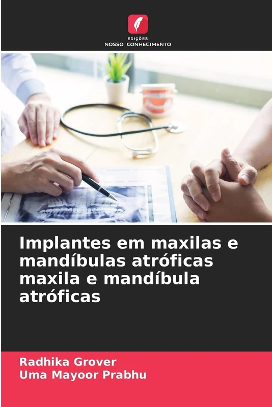 Implantes em maxilas e mandíbulas atróficas maxila e mandíbula atróficas - Image 1