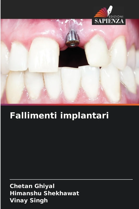 Fallimenti implantari