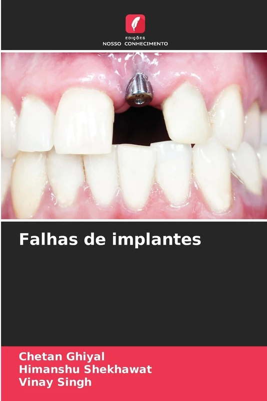 Falhas de implantes
