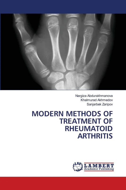 Modern Methods of Treatment of Rheumatoid Arthritis