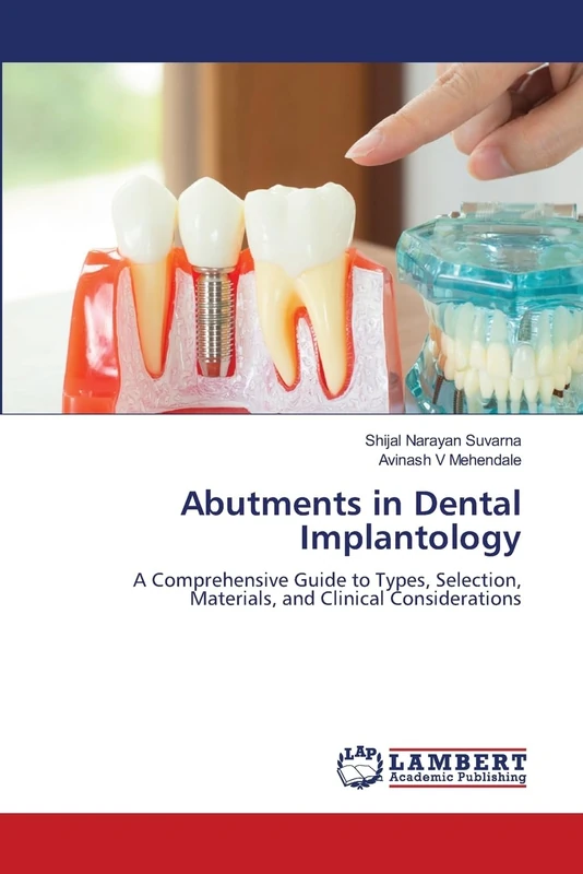 Abutments in Dental Implantology: A Comprehensive Guide to Types, Selection, Materials, and Clinical Considerations