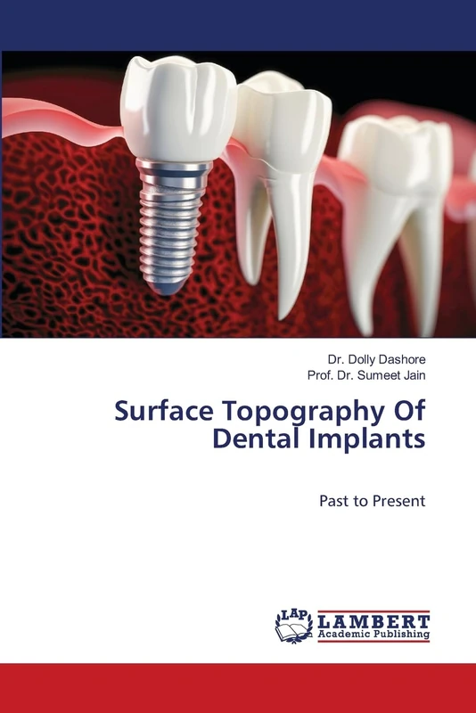 Surface Topography Of Dental Implants: Past to Present