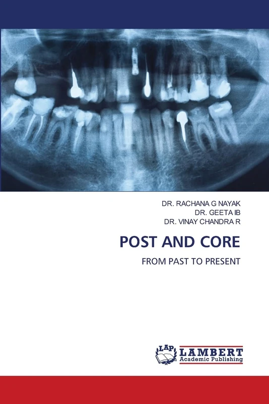 POST AND CORE: FROM PAST TO PRESENT