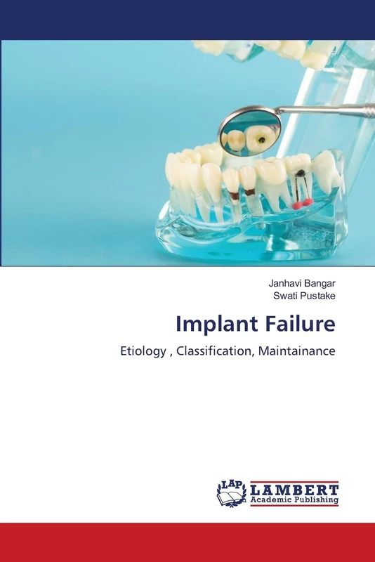 Implant Failure: Etiology , Classification, Maintainance