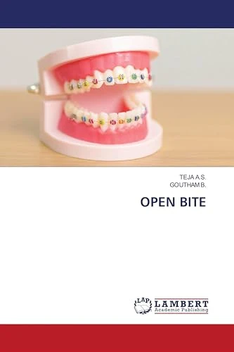 OPEN BITE
