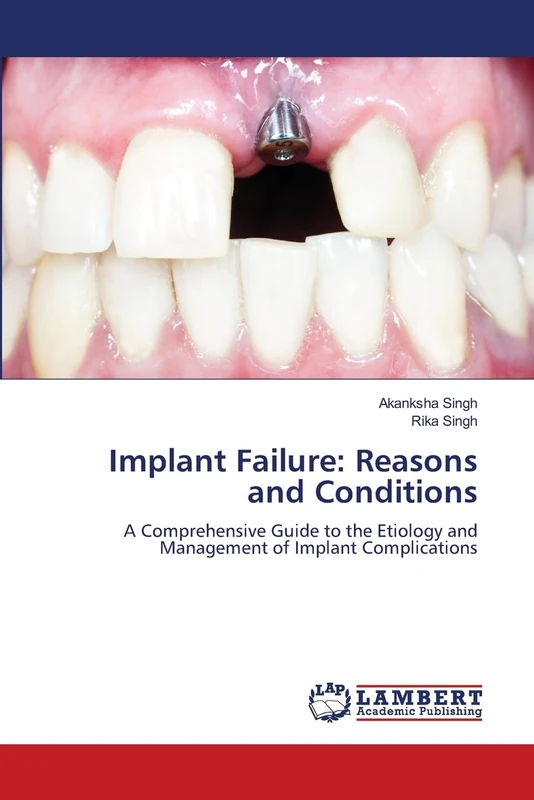 Implant Failure: Reasons and Conditions: A Comprehensive Guide to the Etiology and Management of Implant Complications