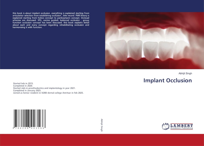 Implant Occlusion