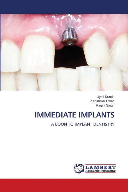 IMMEDIATE IMPLANTS: A BOON TO IMPLANT DENTISTRY