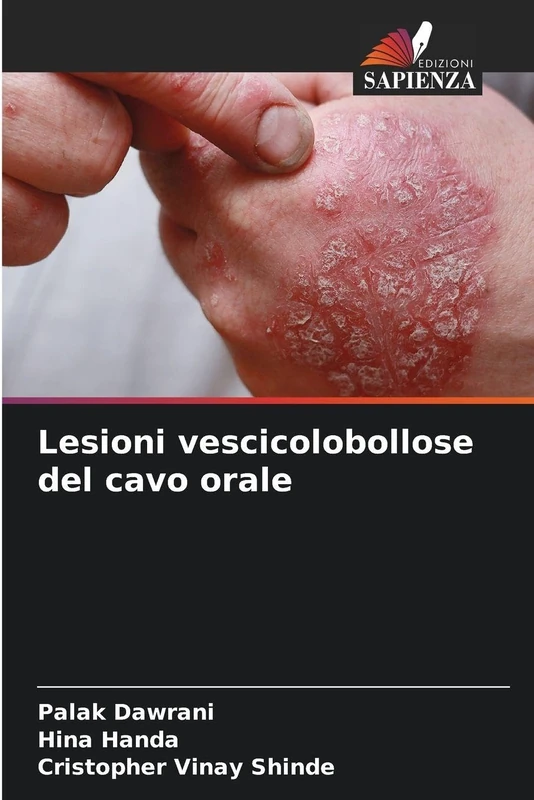 Lesioni vescicolobollose del cavo orale