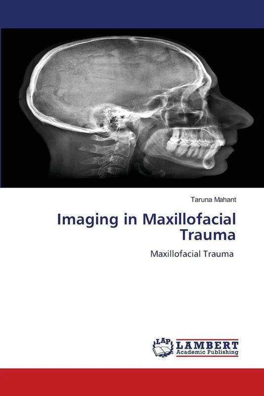 Imaging in Maxillofacial Trauma: Maxillofacial Trauma