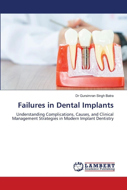 Failures in Dental Implants: Understanding Complications, Causes, and Clinical Management Strategies in Modern Implant Dentistry