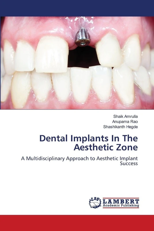 Dental Implants In The Aesthetic Zone: A Multidisciplinary Approach to Aesthetic Implant Success