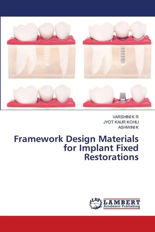 Framework Design Materials for Implant Fixed Restorations