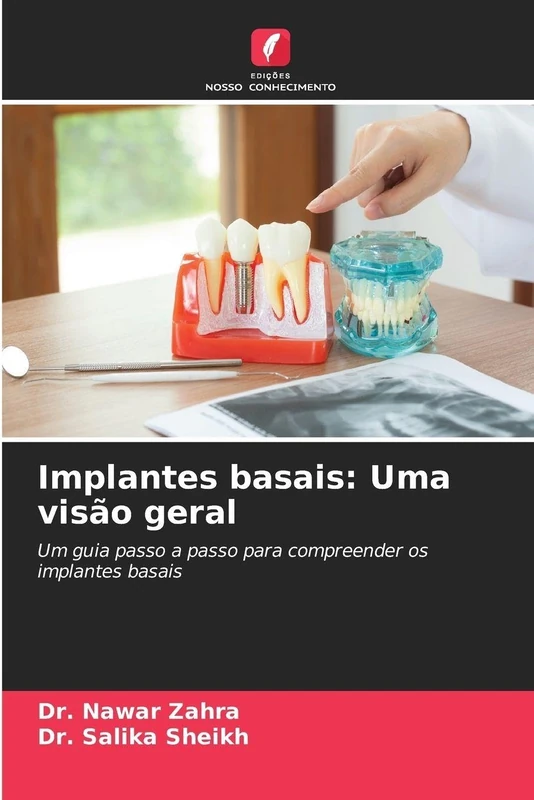 Implantes basais: Uma visão geral: Um guia passo a passo para compreender os implantes basais