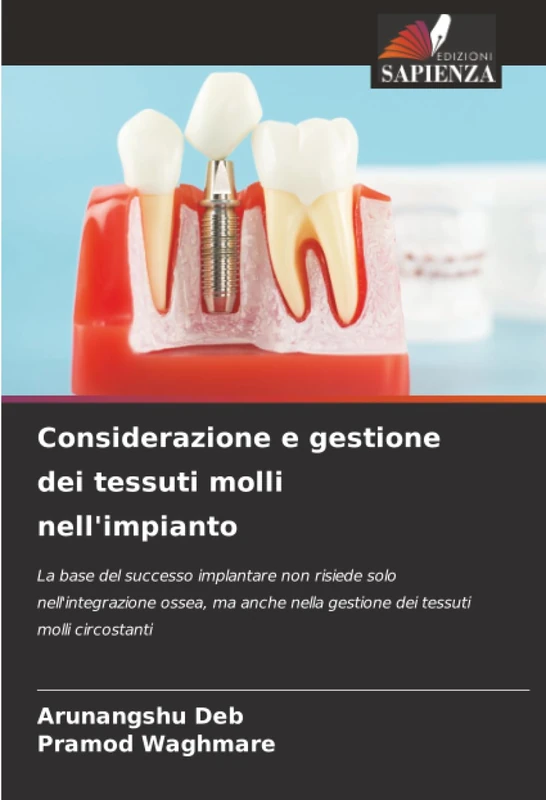 Considerazione e gestione dei tessuti molli nell'impianto: La base del successo implantare non risiede solo nell'integrazione ossea, ma anche nella gestione dei tessuti molli circostanti