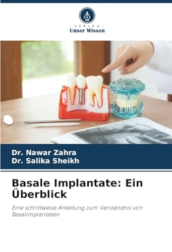 Basale Implantate: Ein Überblick: Eine schrittweise Anleitung zum Verständnis von Basalimplantaten - Image 1