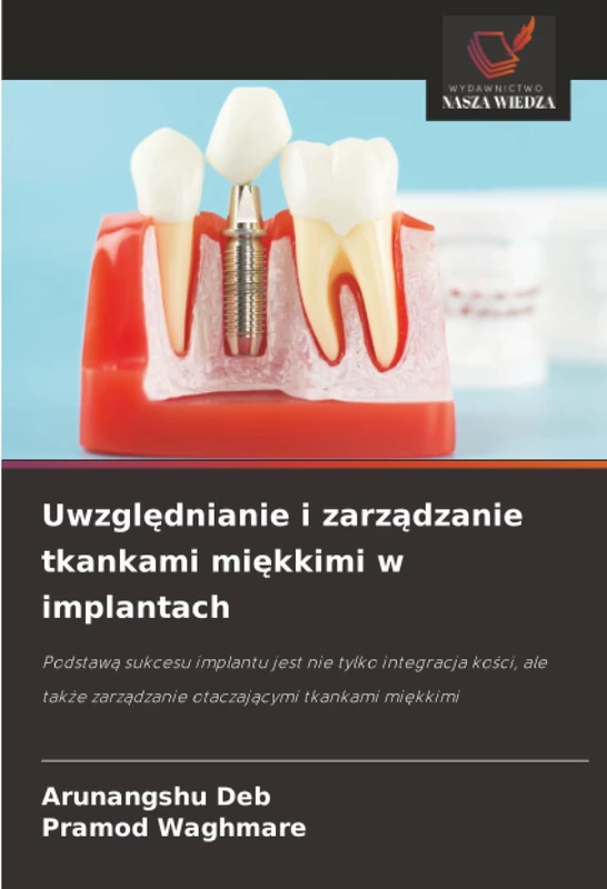 Uwzględnianie i zarządzanie tkankami miękkimi w implantach: Podstawą sukcesu implantu jest nie tylko integracja kości, ale także zarządzanie ... zarz¿dzanie otaczaj¿cymi tkankami mi¿kkimi
