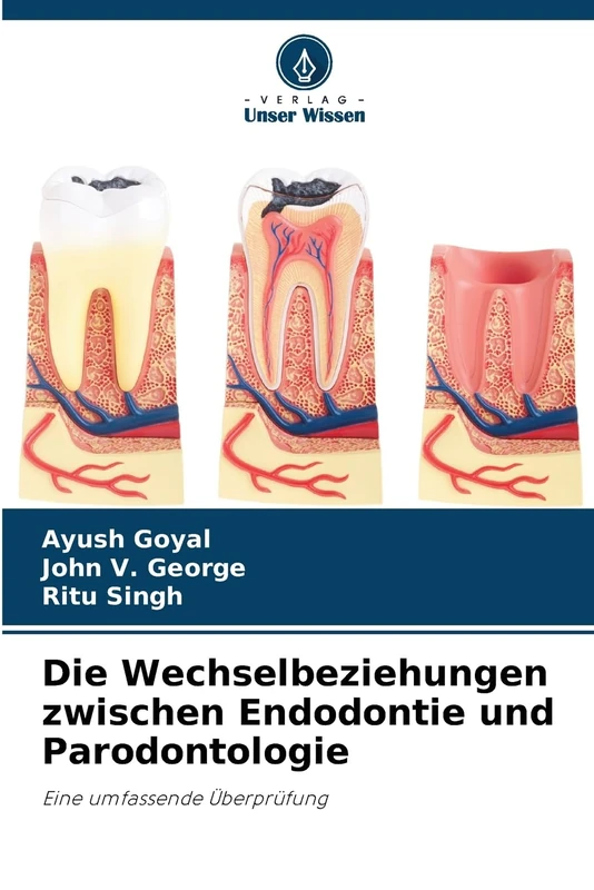 Die Wechselbeziehungen zwischen Endodontie und Parodontologie: Eine umfassende Überprüfung - Image 1
