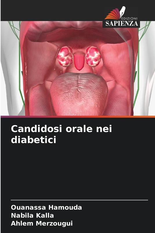 Candidosi orale nei diabetici - Image 1