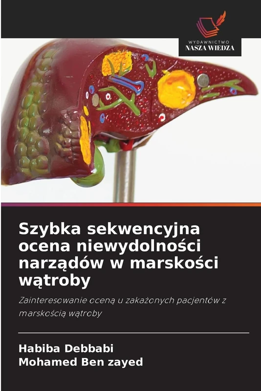 Szybka sekwencyjna ocena niewydolności narządów w marskości wątroby: Zainteresowanie ocen¿ u zaka¿onych pacjentów z marsko¿ci¿ w¿troby - Image 1