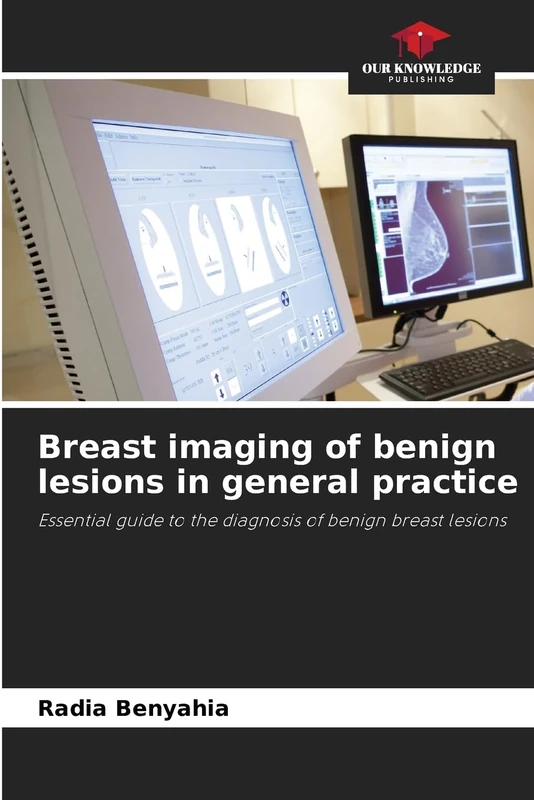 Breast imaging of benign lesions in general practice: Essential guide to the diagnosis of benign breast lesions - Image 1