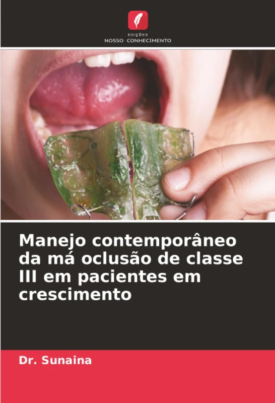 Manejo contemporâneo da má oclusão de classe III em pacientes em crescimento - Image 1