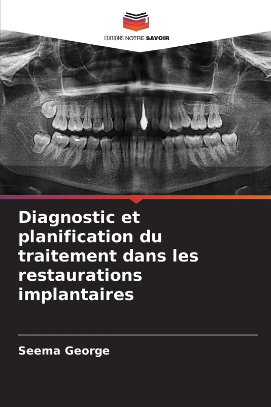 Diagnostic et planification du traitement dans les restaurations implantaires