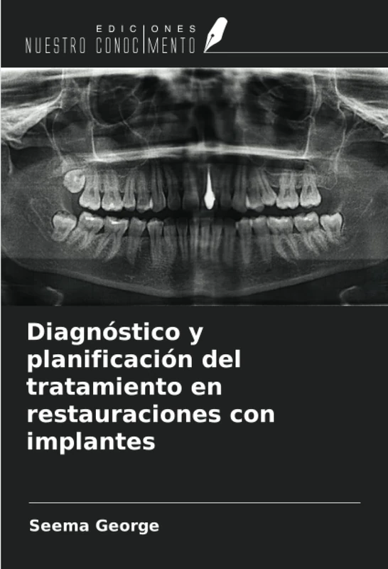 Diagnóstico y planificación del tratamiento en restauraciones con implantes