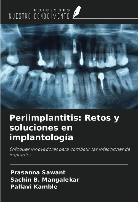 Periimplantitis: Retos y soluciones en implantología: Enfoques innovadores para combatir las infecciones de implantes