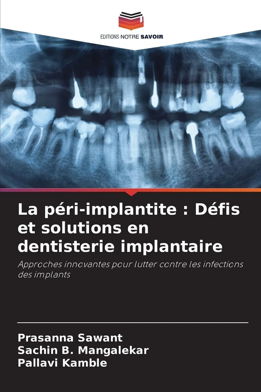 La péri-implantite : Défis et solutions en dentisterie implantaire: Approches innovantes pour lutter contre les infections des implants