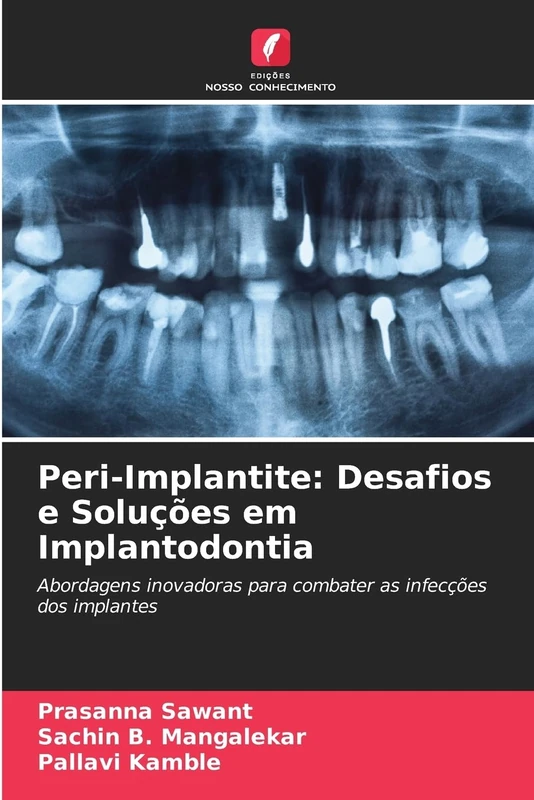 Peri-Implantite: Desafios e Soluções em Implantodontia: Abordagens inovadoras para combater as infecções dos implantes