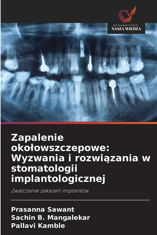 Zapalenie okołowszczepowe: Wyzwania i rozwiązania w stomatologii implantologicznej: Zwalczanie zakażeń implantów
