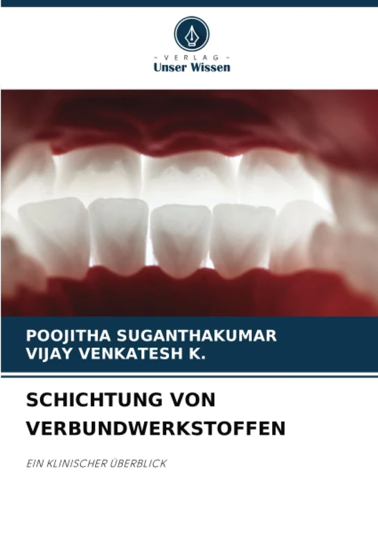 SCHICHTUNG VON VERBUNDWERKSTOFFEN: EIN KLINISCHER ÜBERBLICK